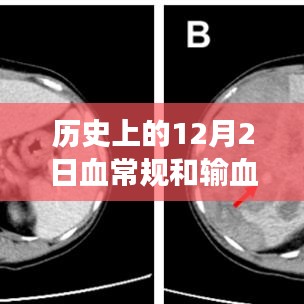 歷史上的12月2日，血常規與輸血技術的重大進展與回顧