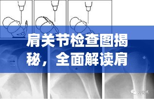 肩關節檢查圖揭秘，全面解讀肩關節健康與功能狀態