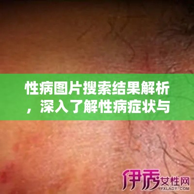 性病圖片搜索結果解析，深入了解性病癥狀與防治知識
